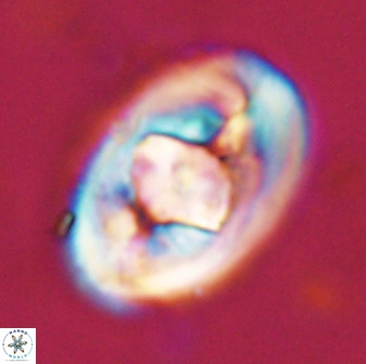 Zeugrhabdotus embergeri 48292