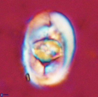 Zeugrhabdotus embergeri 48293