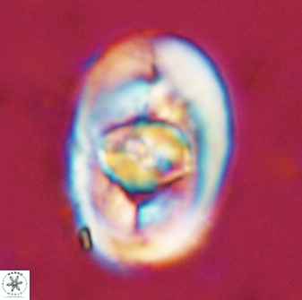 Zeugrhabdotus embergeri 48293