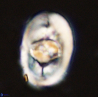 Zeugrhabdotus embergeri 48294