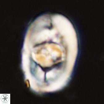 Zeugrhabdotus embergeri 48294