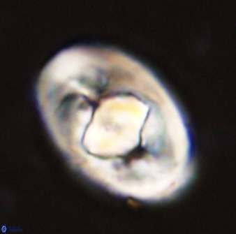 Zeugrhabdotus embergeri 48295