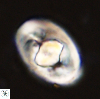 Zeugrhabdotus embergeri 48295