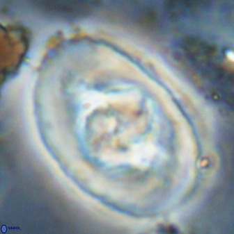 Zeugrhabdotus embergeri 48200