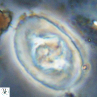 Zeugrhabdotus embergeri 48200