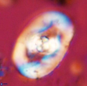 Zeugrhabdotus embergeri 48204