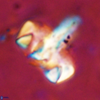 Zeugrhabdotus embergeri 48843