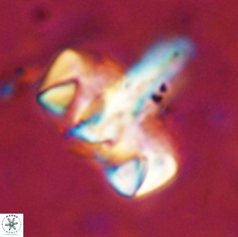 Zeugrhabdotus embergeri 48843