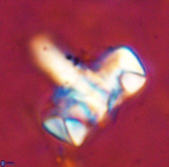Zeugrhabdotus embergeri 48847