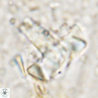 Zeugrhabdotus embergeri 48848