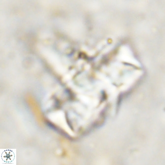Zeugrhabdotus embergeri 48849