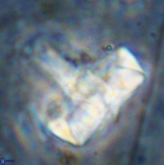 Zeugrhabdotus embergeri 48852