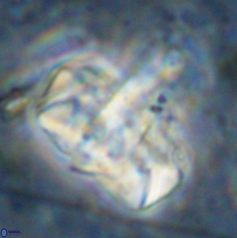 Zeugrhabdotus embergeri 48853