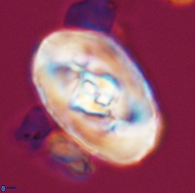 Zeugrhabdotus embergeri 11522
