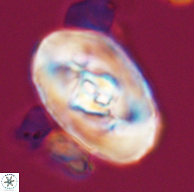 Zeugrhabdotus embergeri 11522