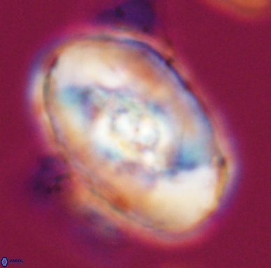 Zeugrhabdotus embergeri 11523