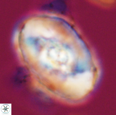 Zeugrhabdotus embergeri 11523