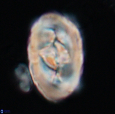 Zeugrhabdotus embergeri 11525