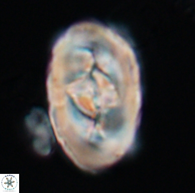 Zeugrhabdotus embergeri 11525