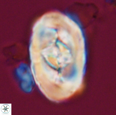 Zeugrhabdotus embergeri 11526
