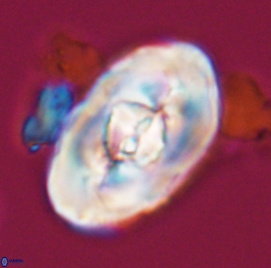 Zeugrhabdotus embergeri 11527