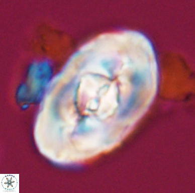 Zeugrhabdotus embergeri 11527