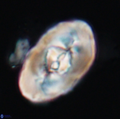Zeugrhabdotus embergeri 11528