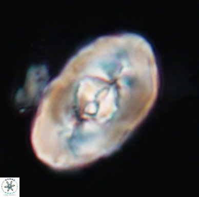 Zeugrhabdotus embergeri 11528