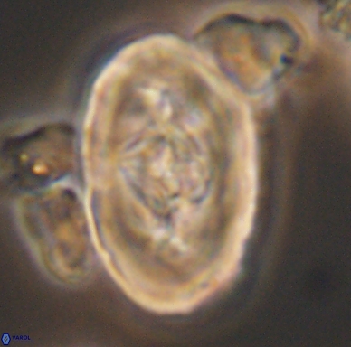 Zeugrhabdotus embergeri 11530