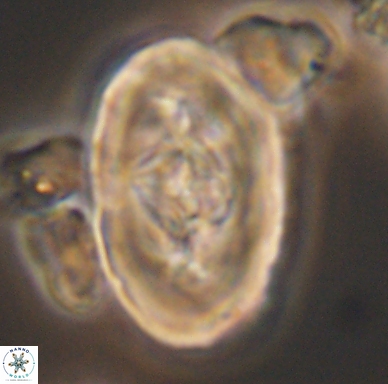 Zeugrhabdotus embergeri 11530
