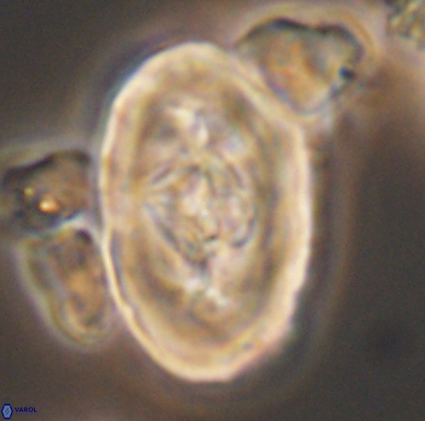Zeugrhabdotus embergeri 11531