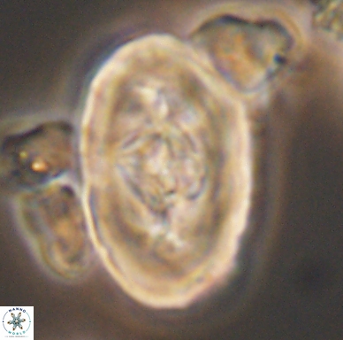 Zeugrhabdotus embergeri 11531
