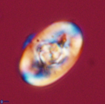 Zeugrhabdotus embergeri 39289