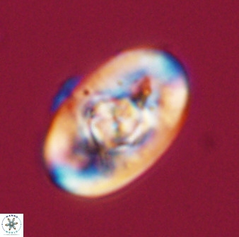 Zeugrhabdotus embergeri 39289