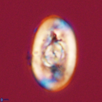 Zeugrhabdotus embergeri 39290