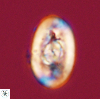 Zeugrhabdotus embergeri 39290