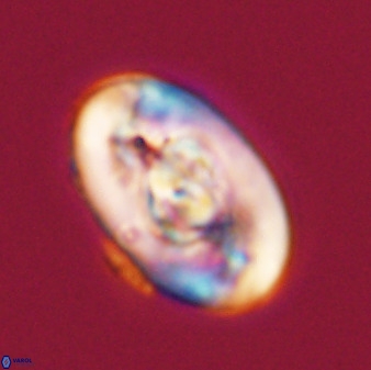 Zeugrhabdotus embergeri 39293