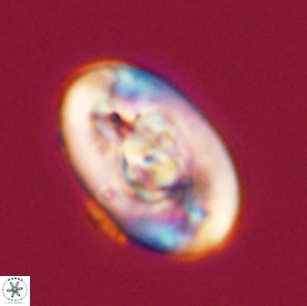 Zeugrhabdotus embergeri 39293