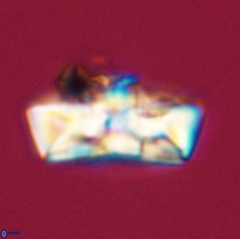 Zeugrhabdotus embergeri 39294