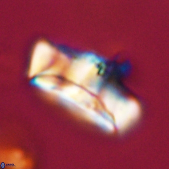 Zeugrhabdotus embergeri 39299
