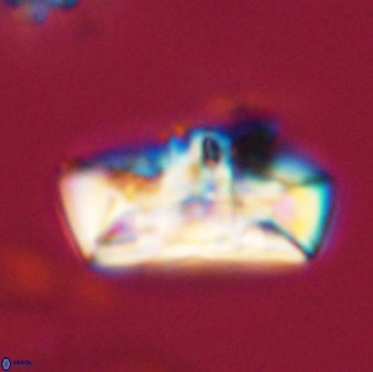 Zeugrhabdotus embergeri 39302