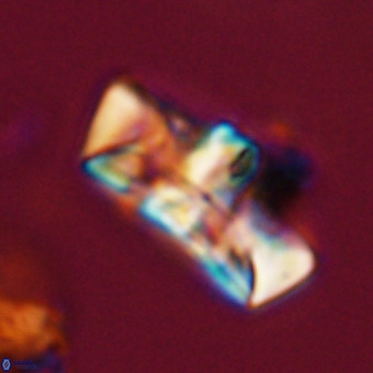 Zeugrhabdotus embergeri 39309