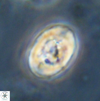 Zeugrhabdotus kerguelenensis 48315