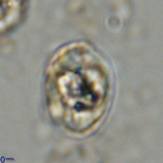 Zeugrhabdotus kerguelenensis 48310