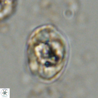 Zeugrhabdotus kerguelenensis 48310