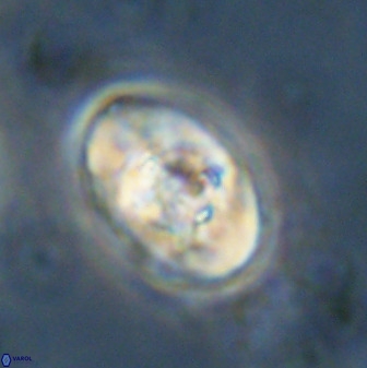 Zeugrhabdotus kerguelenensis 48313