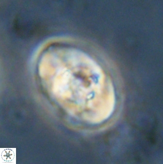 Zeugrhabdotus kerguelenensis 48313