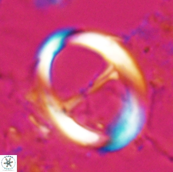 Zygodiscus cearae 24981