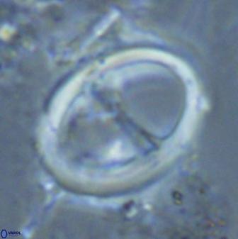 Zygodiscus cearae 24987