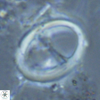Zygodiscus cearae 24987